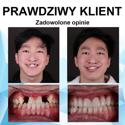 EzxGrin™ Zestaw wkładek silikonowych do protez💎 (⏰60% zniżki na ograniczony czas, dziś darmowa dostawa!⏰)