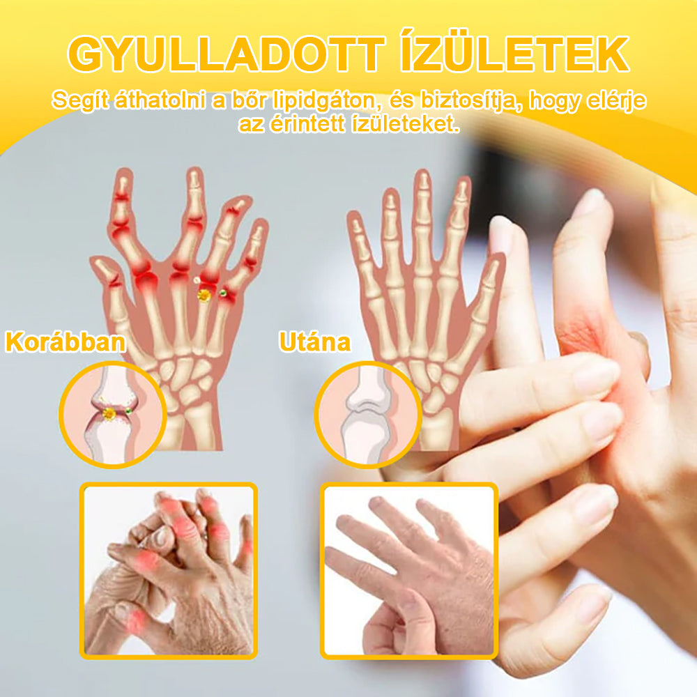 [HIVATALOS BOLT🛡️] Gbpurity™ Méhmérég És Glükózamin Ízületi Gyógy Krém(Kifejezetten idősek számára tervezve, 👨‍⚕️ Ajánlja a MOT.)