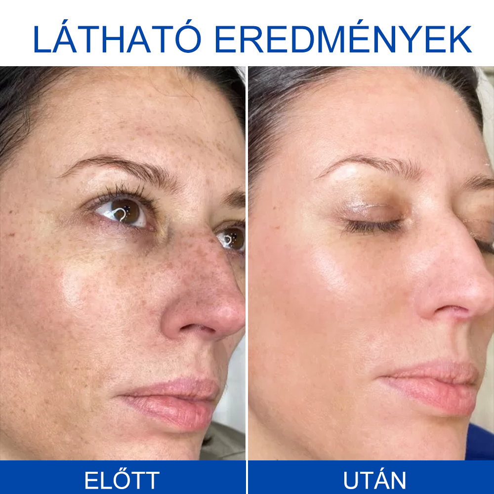 🩵REHELY™ Háromszoros Regeneráló Hidratáló Krém|BOTOX,RETINOL&HIALURONSAV|Mélyhidratálás és táplálásTudományosan bizonyított formula