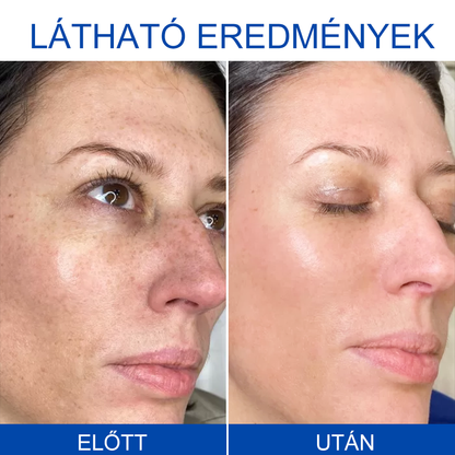 🩵REHELY™ Háromszoros Regeneráló Hidratáló Krém|BOTOX,RETINOL&HIALURONSAV|Mélyhidratálás és táplálásTudományosan bizonyított formula