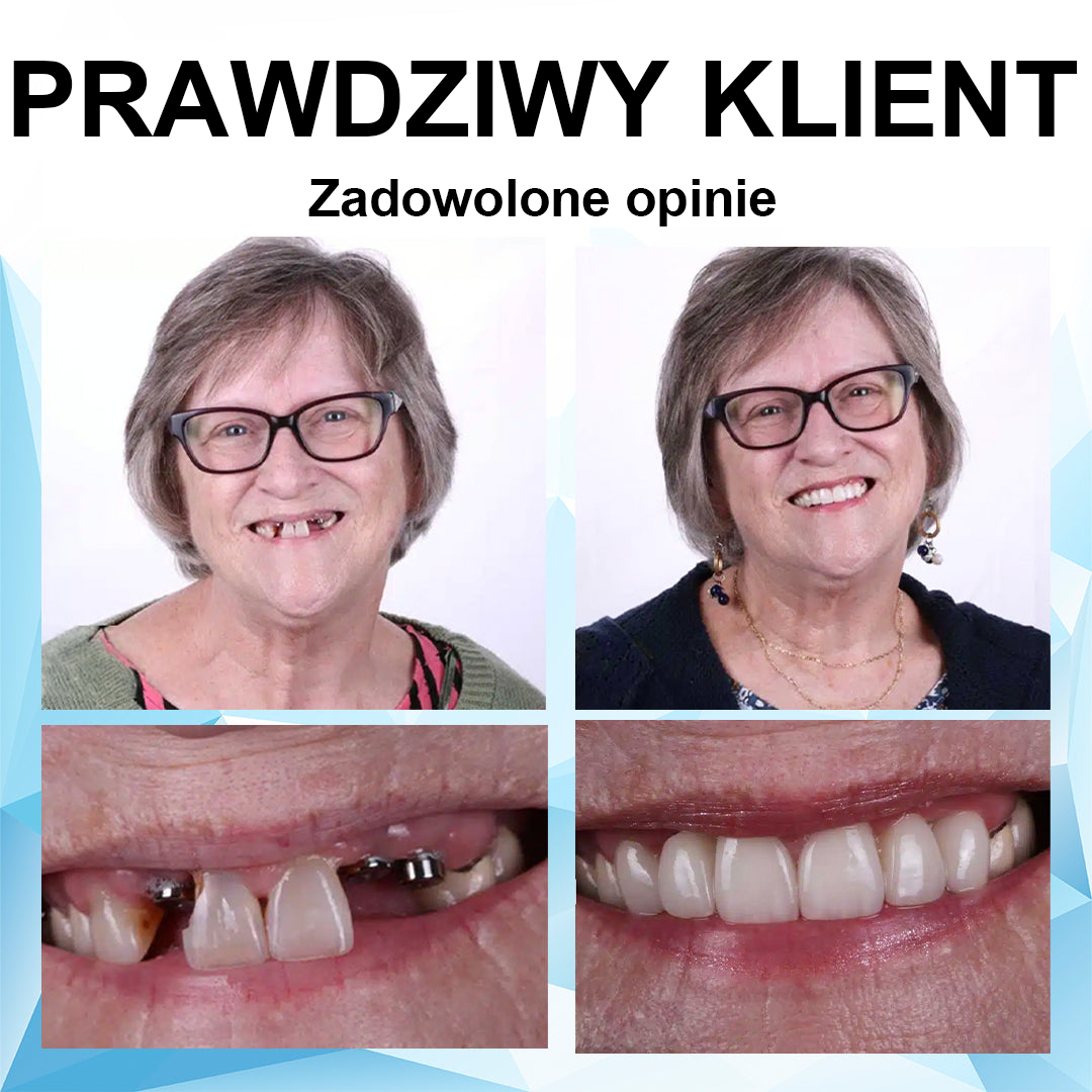 EzxGrin™ Zestaw wkładek silikonowych do protez💎 (⏰60% zniżki na ograniczony czas, dziś darmowa dostawa!⏰)