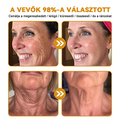 🌸FRISSARC™ Botox Méhméreg Ránctalanító Krém