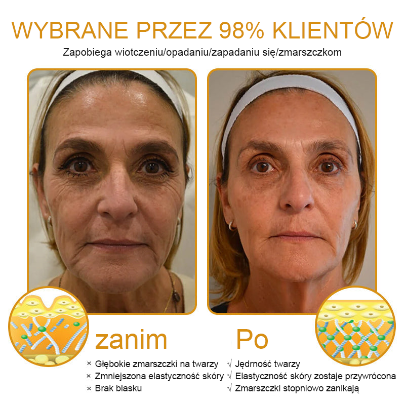 FrissArc™ Botox Jadem Pszczelim przeciwzmarszczkowy Krem – Redukuje zmarszczki, ujędrnia i rozjaśnia skórę – Krem przeciwstarzeniowy o podwójnym działaniu!