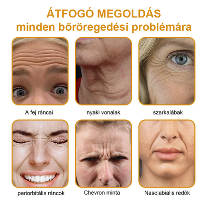 🌸FRISSARC™ Botox Méhméreg Ránctalanító Krém