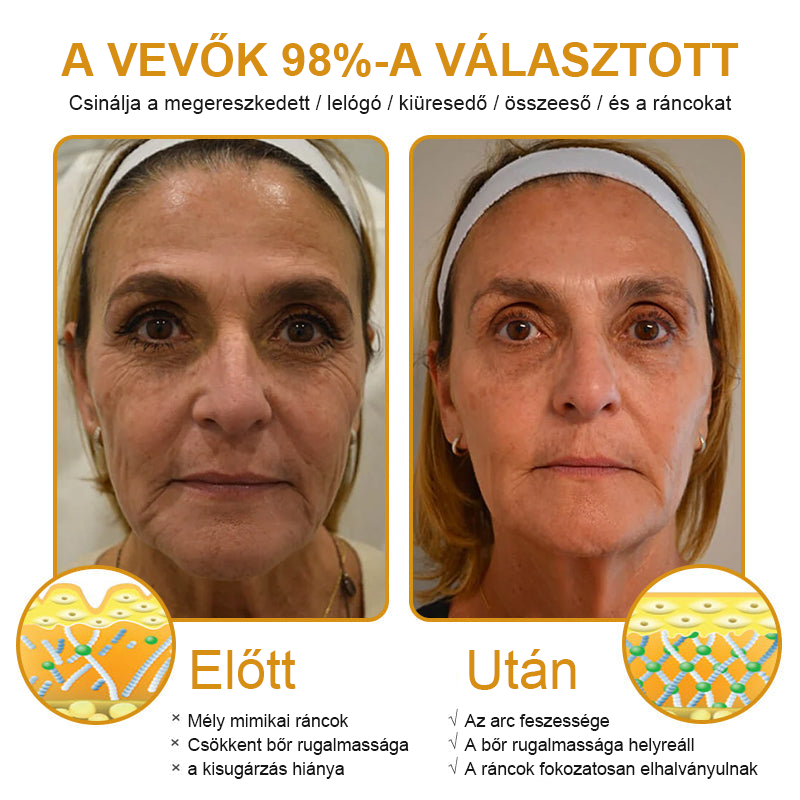 【Hivatalos Márkabolt】FRISSARC™ Botox Méhméreg Ránctalanító Krém