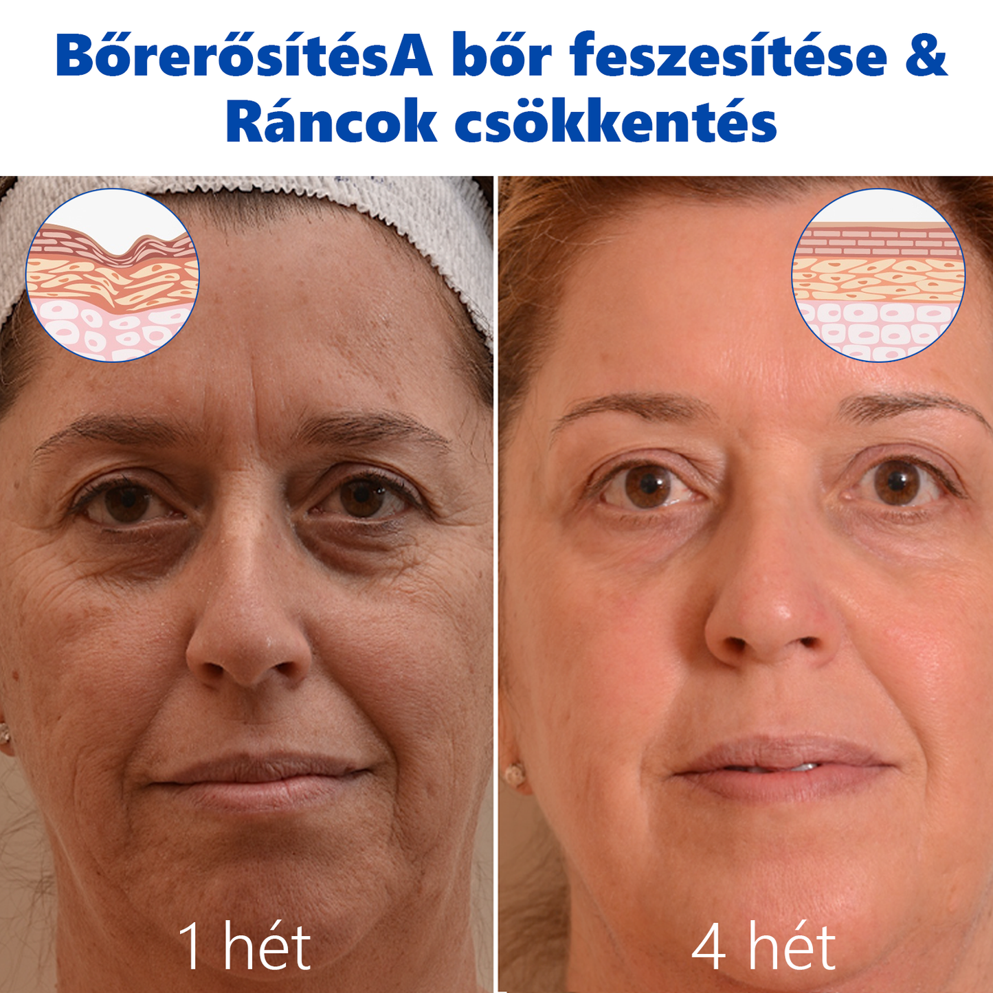 🩵REHELY™ Háromszoros Regeneráló Hidratáló Krém|BOTOX,RETINOL&HIALURONSAV|Mélyhidratálás és táplálásTudományosan bizonyított formula