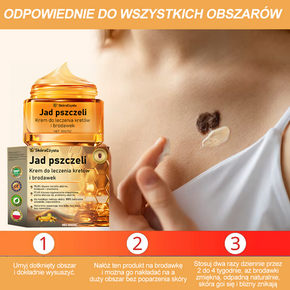 💝[✨Oficjalny sklep markowy✨] FROPUN™ Jad pszczeliKrem do leczenia kretów i brodawek (👨‍⚕️PTD AJÁNLJA)