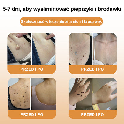 💝[✨Oficjalny sklep markowy✨] FROPUN™ Jad pszczeliKrem do leczenia kretów i brodawek (👨‍⚕️PTD AJÁNLJA)