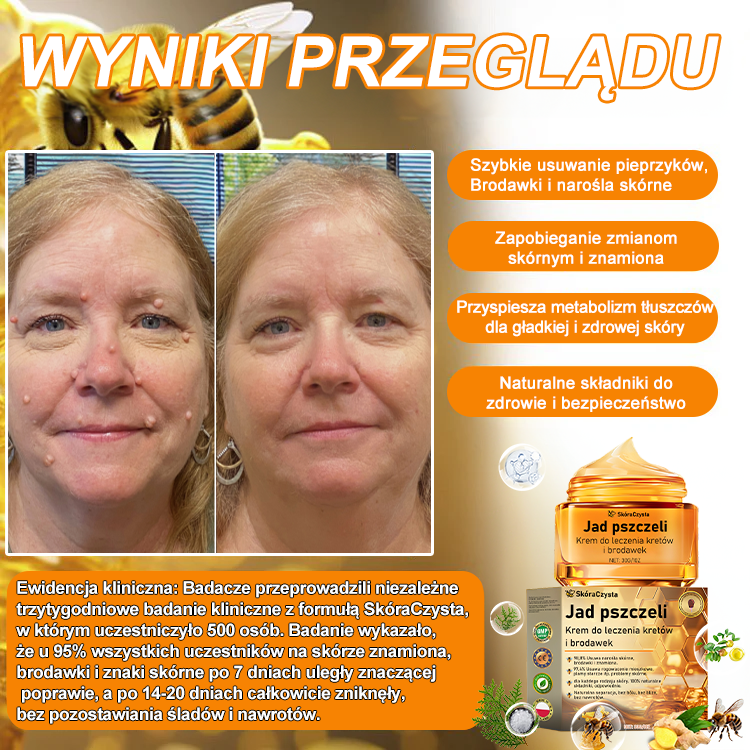 💝[✨Oficjalny sklep markowy✨] FROPUN™ Jad pszczeliKrem do leczenia kretów i brodawek (👨‍⚕️PTD AJÁNLJA)