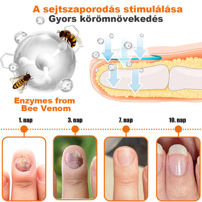 [✨Hivatalos Márkabolt✨] 💝KörömVital™ Méhméreg Baktériumölő Körömkezelő Szérum
