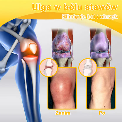 🐝🔥StawVital® Krem z Jadem Pszczelim Leczniczy do Regeneracji Stawów(Nowozelandzki ekstrakt z pszczół — opracowany specjalnie na problemy ortopedyczne i ból stawów)