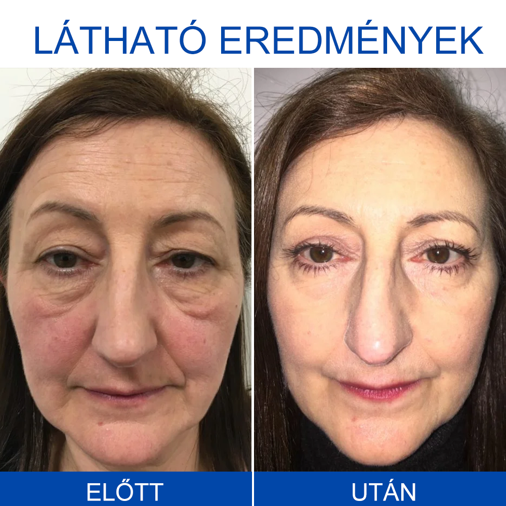 🩵REHELY™ Háromszoros Regeneráló Hidratáló Krém|BOTOX,RETINOL&HIALURONSAV|Mélyhidratálás és táplálásTudományosan bizonyított formula