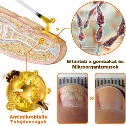 [✨Hivatalos Márkabolt✨] 💝KörömVital™ Méhméreg Baktériumölő Körömkezelő Szérum